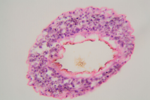 Schistosoma mansoni: parásito