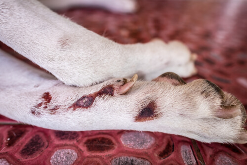 Cómo identificar la dermatitis acral