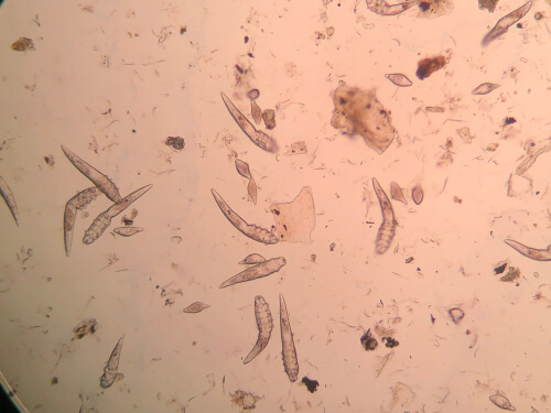 Demodex canis mites.