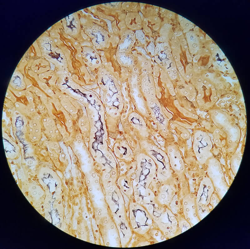 La Leptospira provoca la leptospirosis en gatos