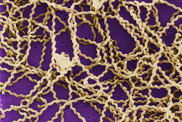 Bacteria de la leptospirosis en gatos