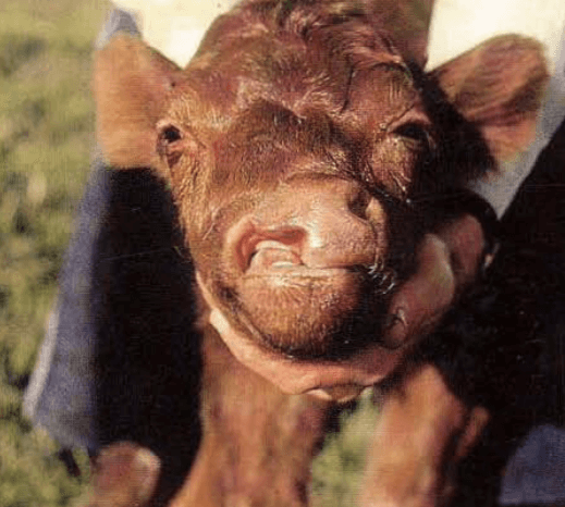 Konjenital kusurlar.