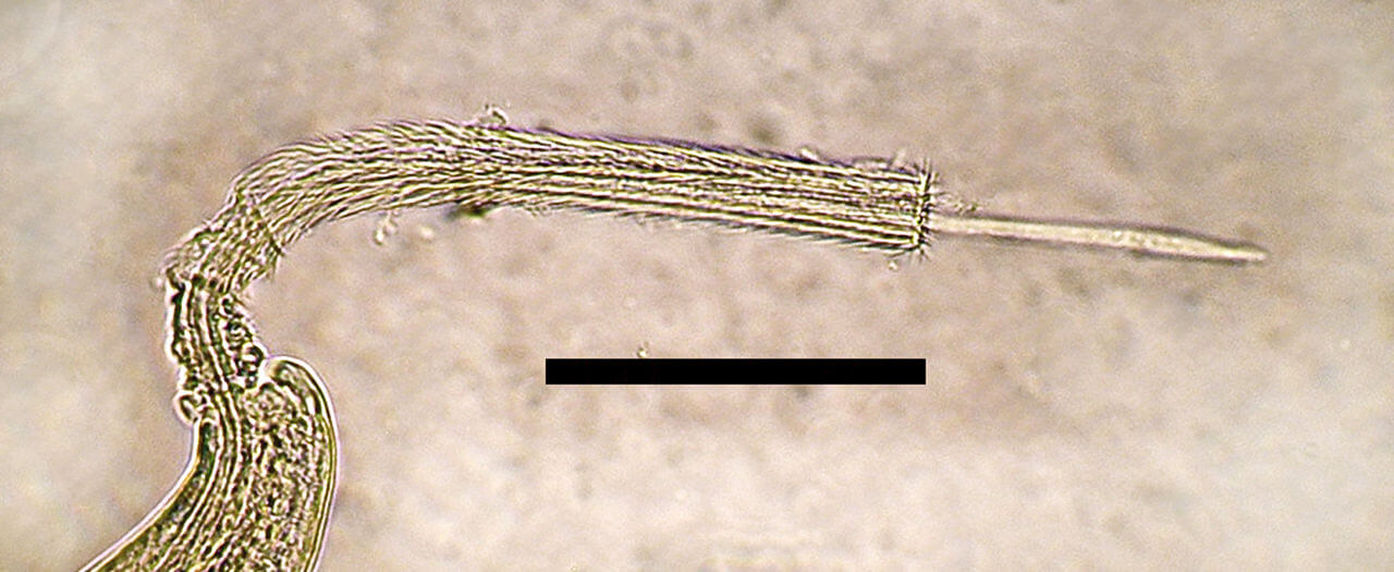 Nematodo Capilaria