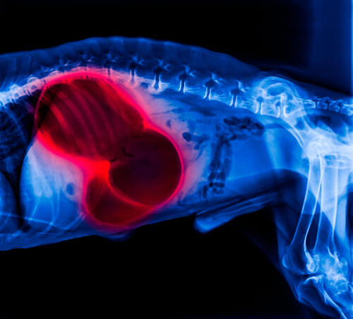 Radiografía abdominal