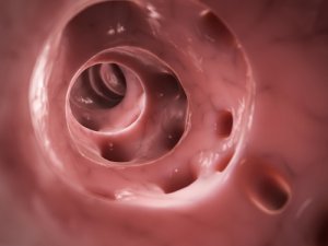Diverticulitis en perros: causas y tratamientos