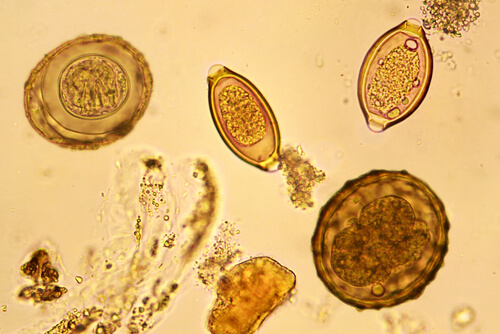 Huevo de helminto en heces visto en el microscopio.