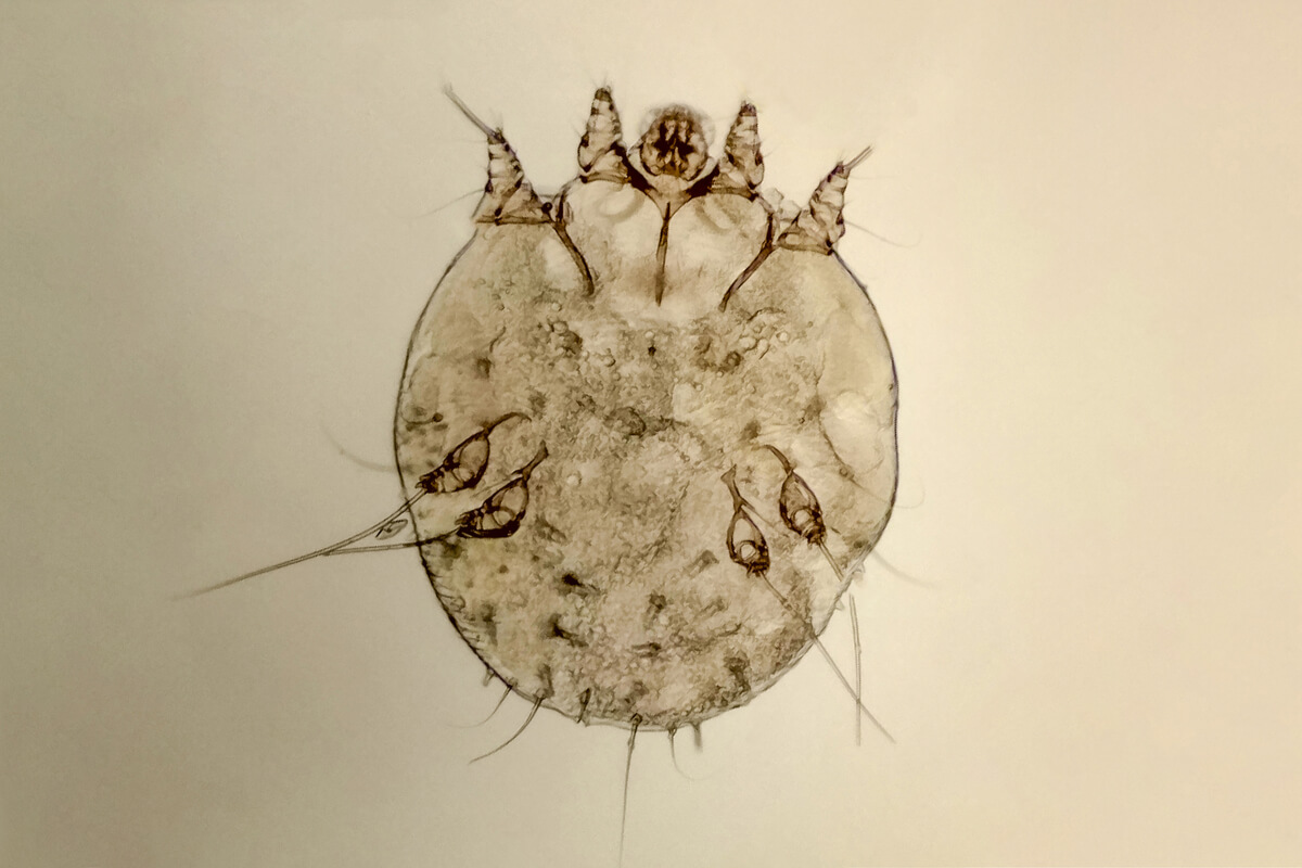 Una garrapata al microscopio.