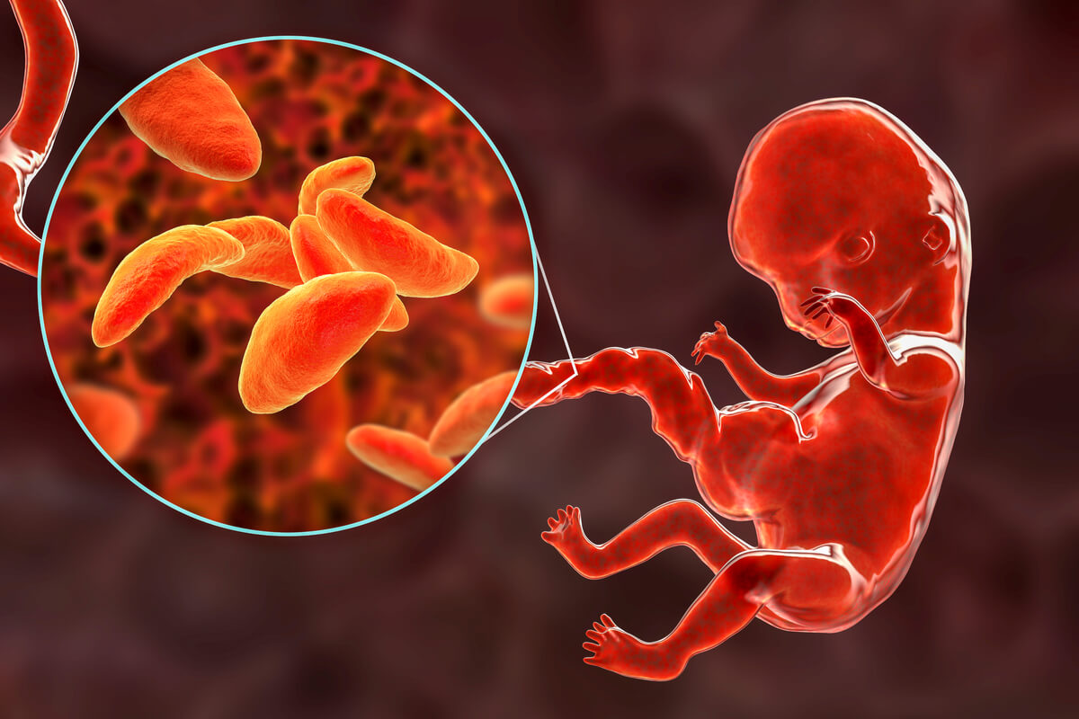 Un feto humano con toxoplasmosis.