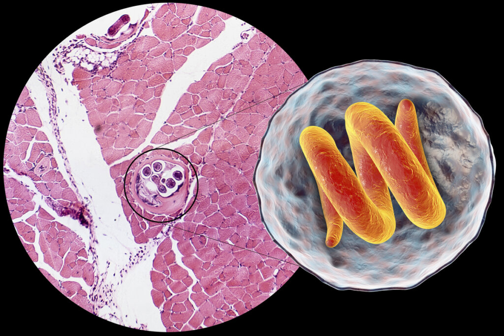 La triquinelosis: ¿un problema de salud animal o de salud pública?