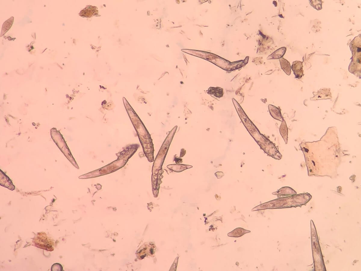 Ácaros del género Demodex vistos al microscopio.