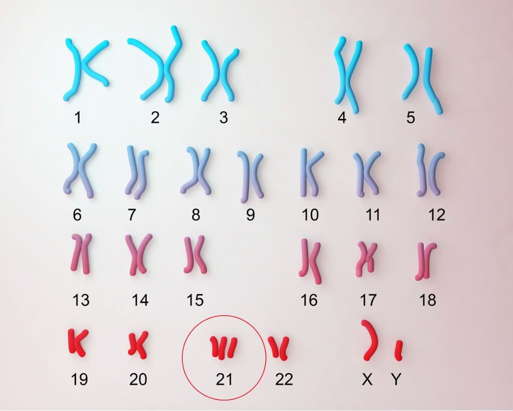 En el síndrome de Down, el cromosoma 21 tiene una copia extra.