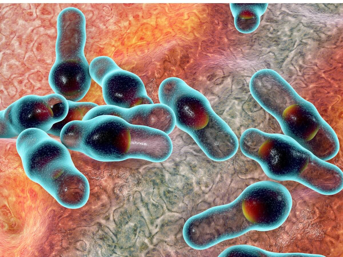 Una bacteria botulínica.