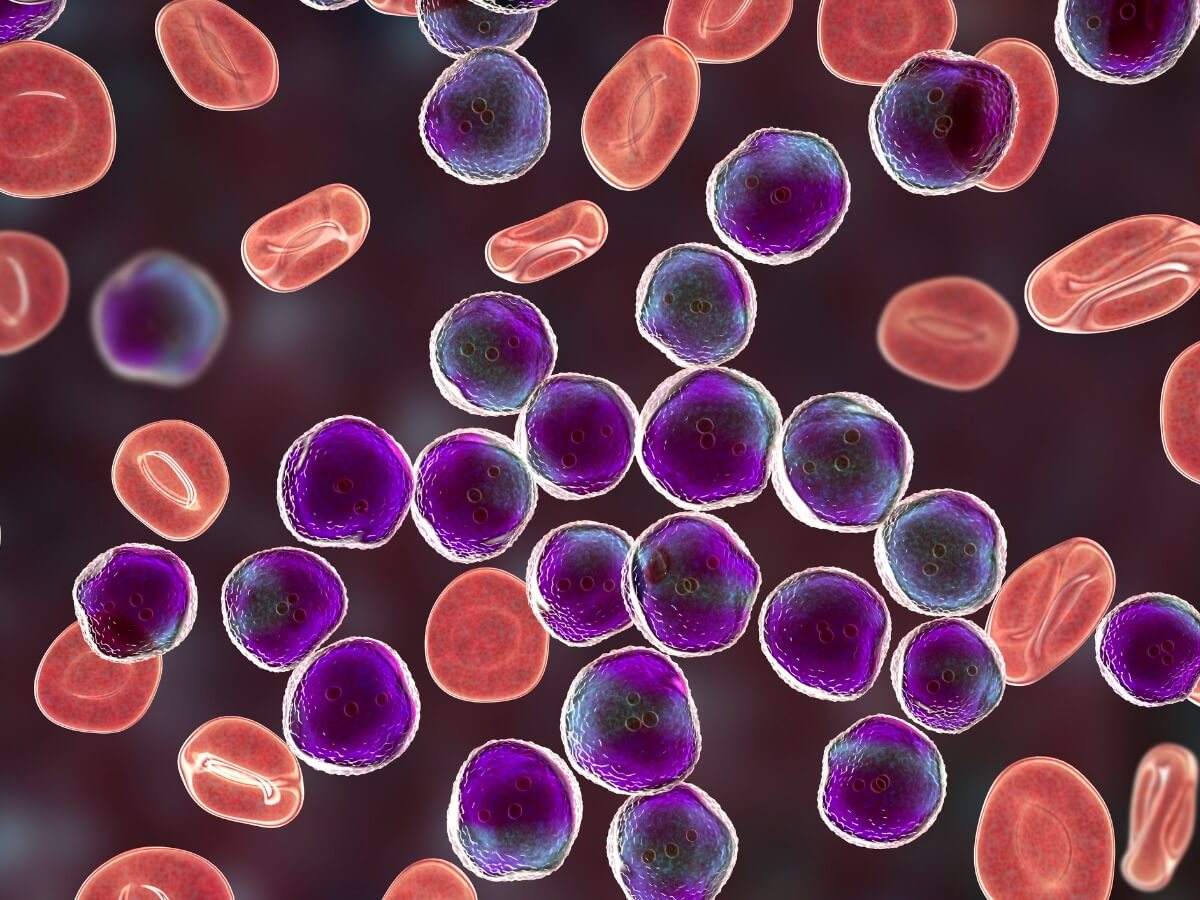 Kandaki lenfoma örneği.