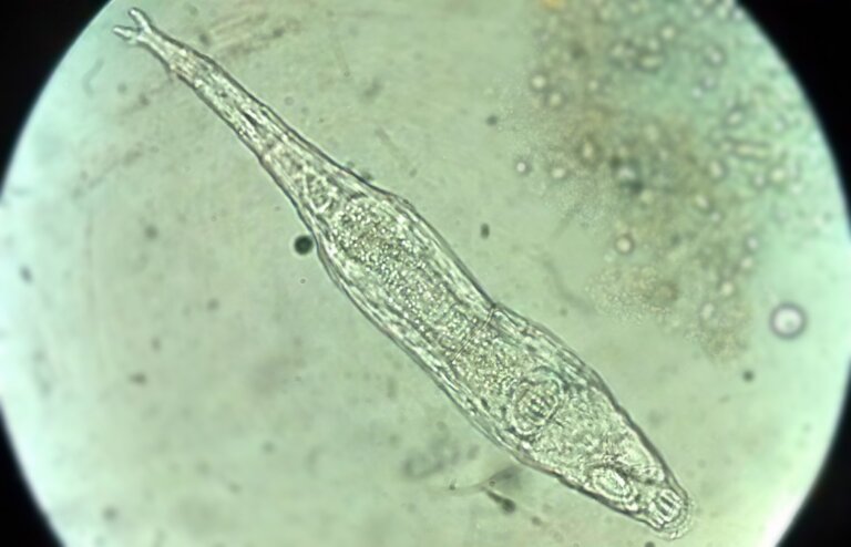 Bdelloidea: microorganismo de hace 24 000 años volvió a la vida